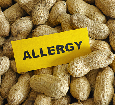 Global Peanut Allergy Therapeutics Market 2019-2023